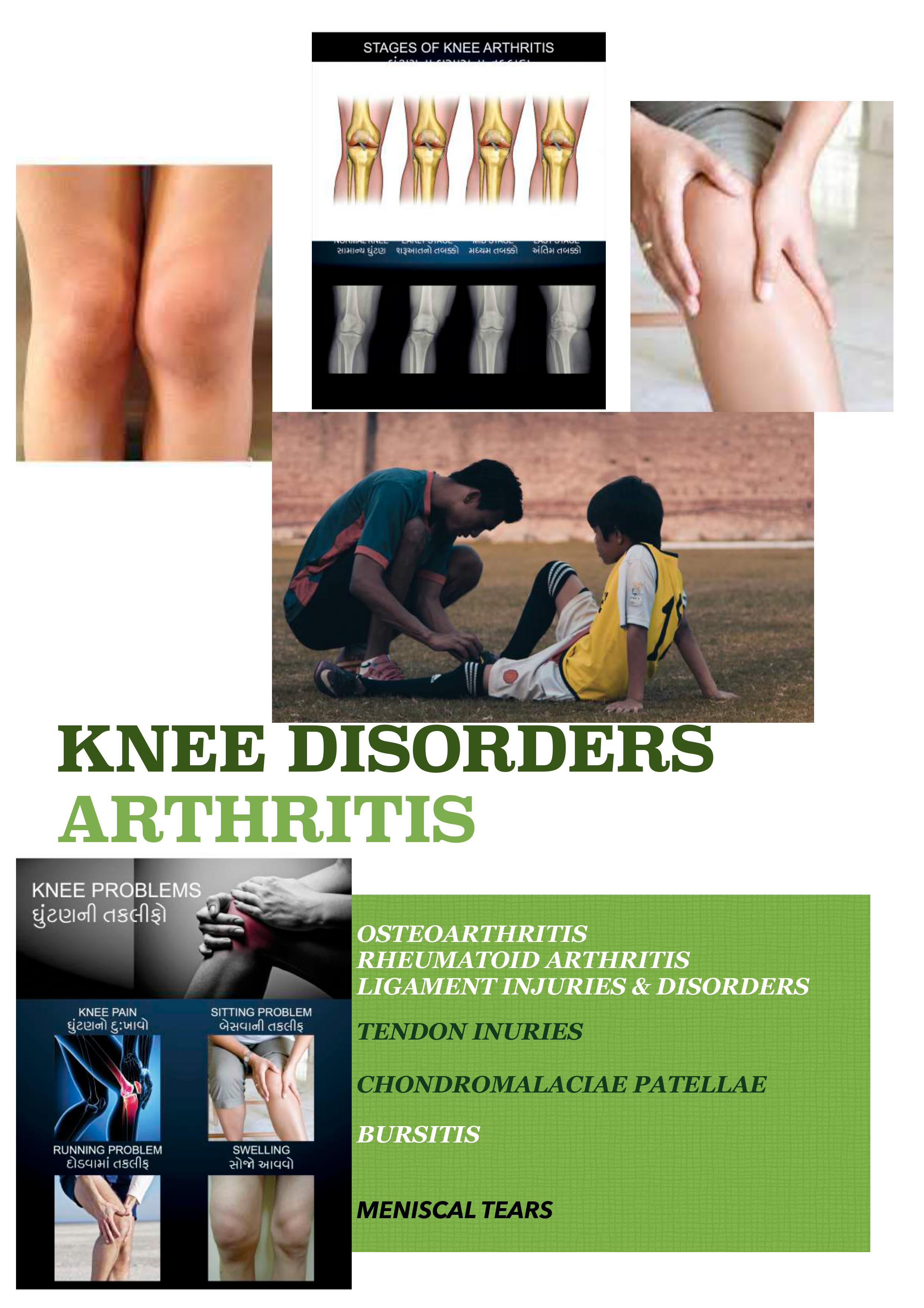 knee disorders arthritis