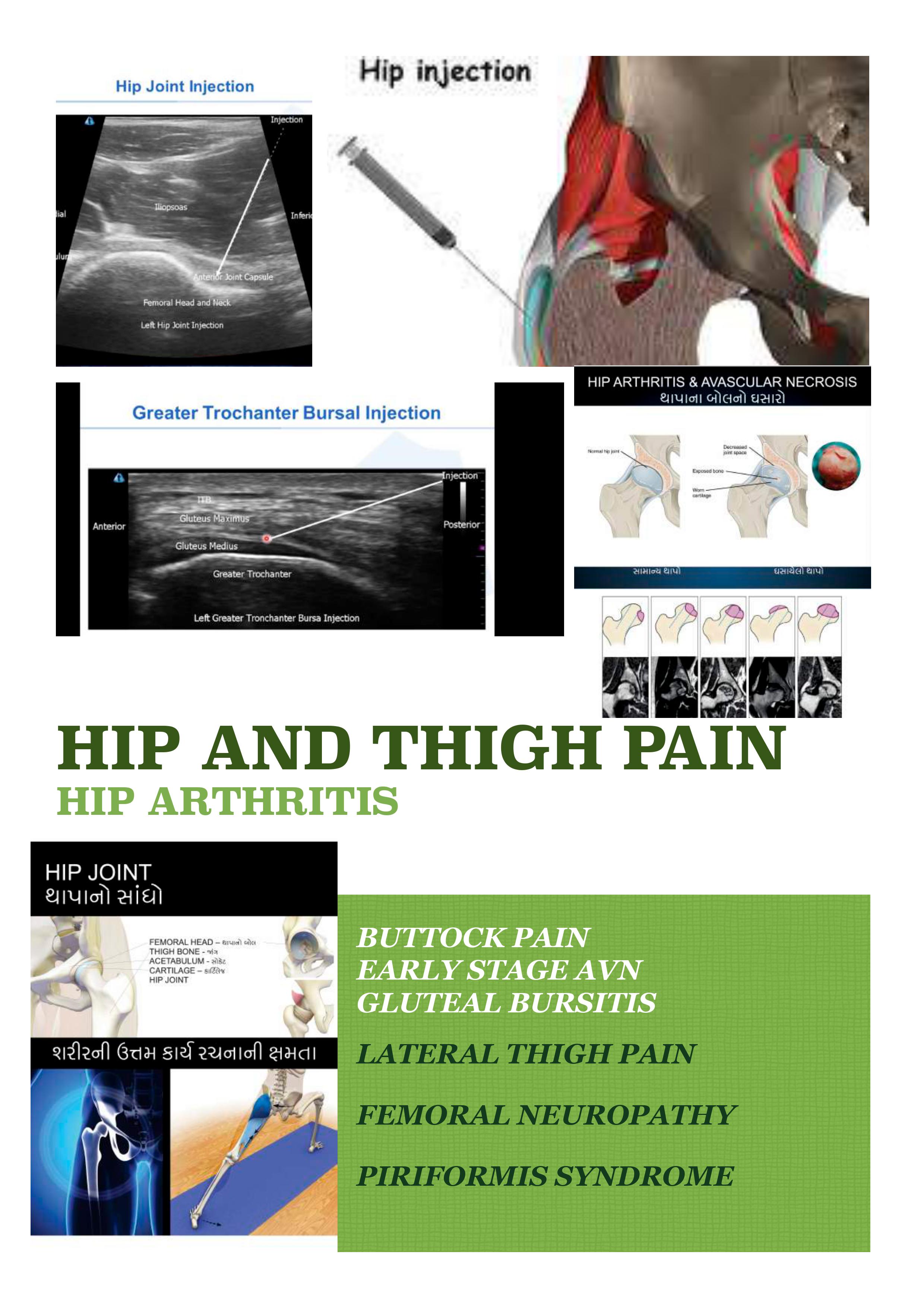 hip and thigh pain