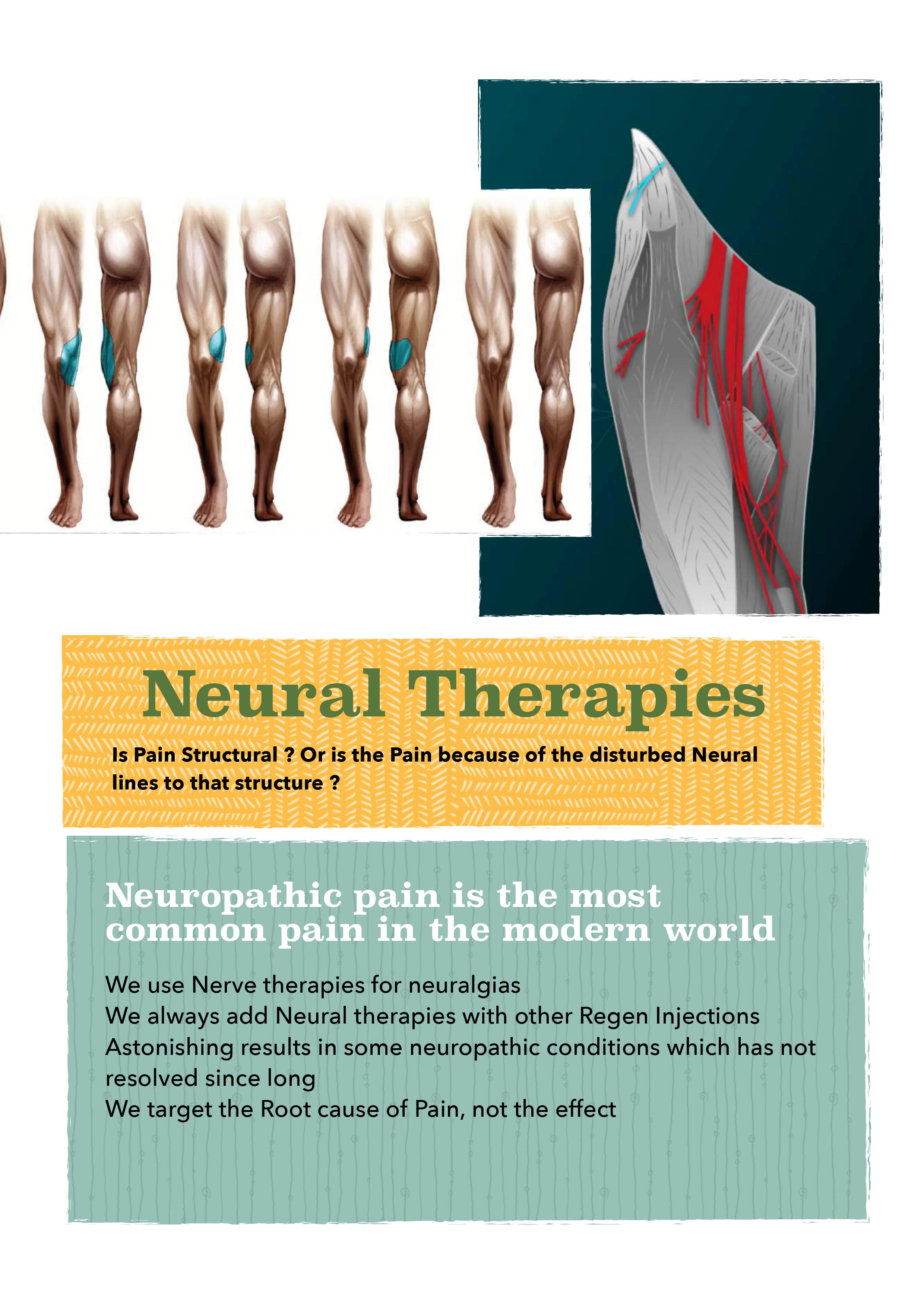 neural therapies