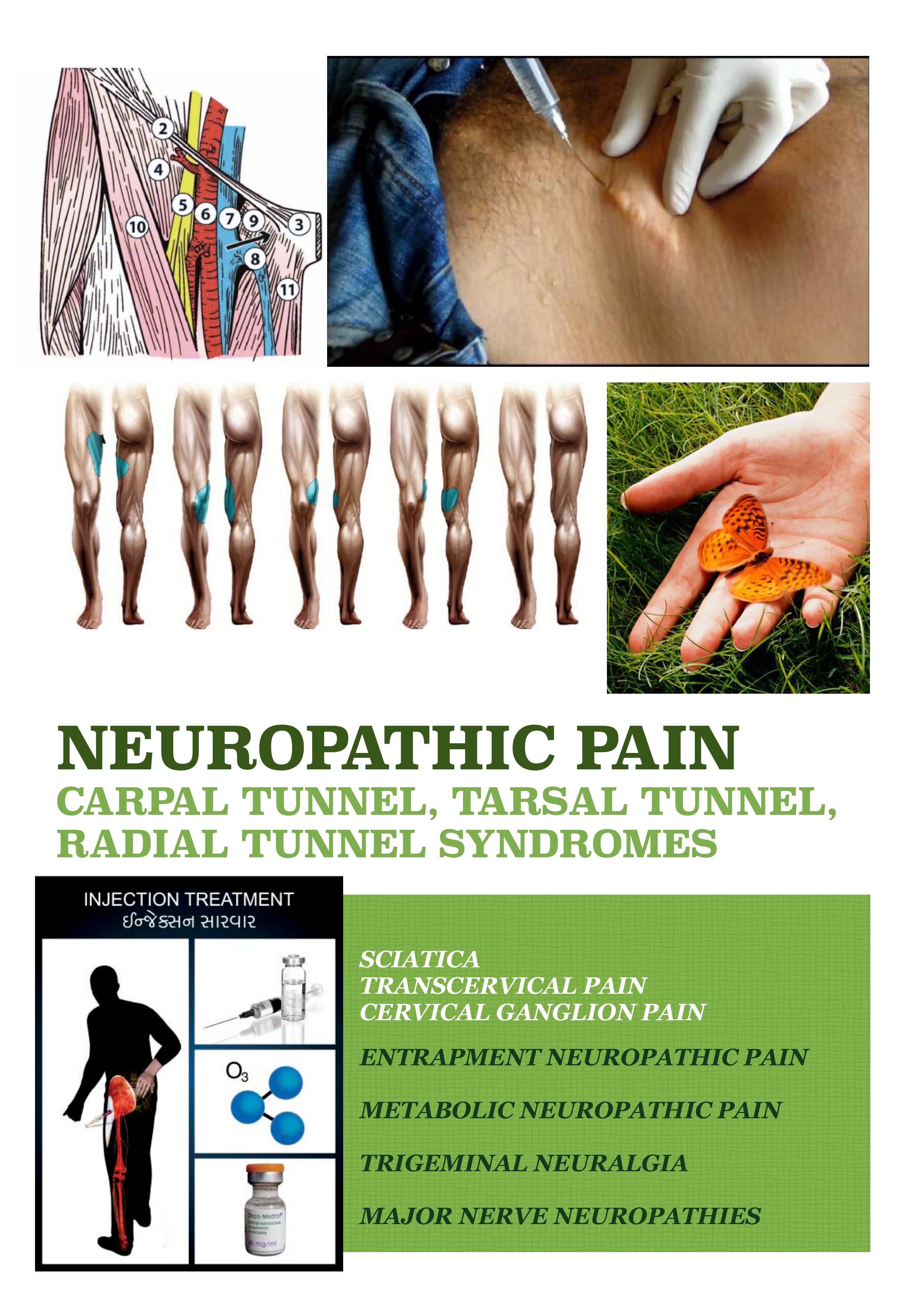 neuropathic pain